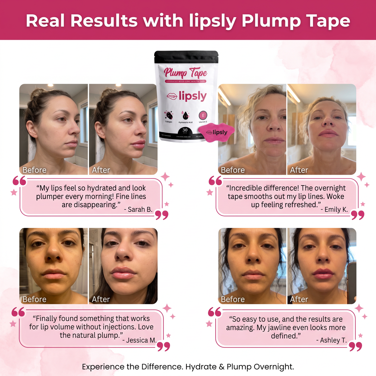 Lipsly™ - Plumper, Softer-Looking Lips, Overnight